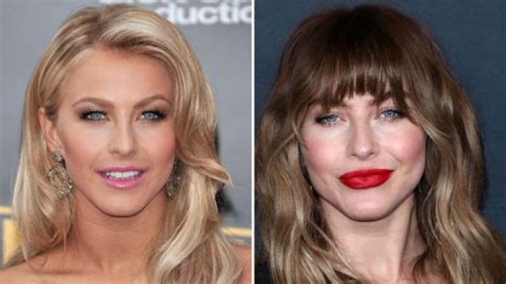 Julianne Hough: The Journey Of Transformation Through Plastic Surgery
